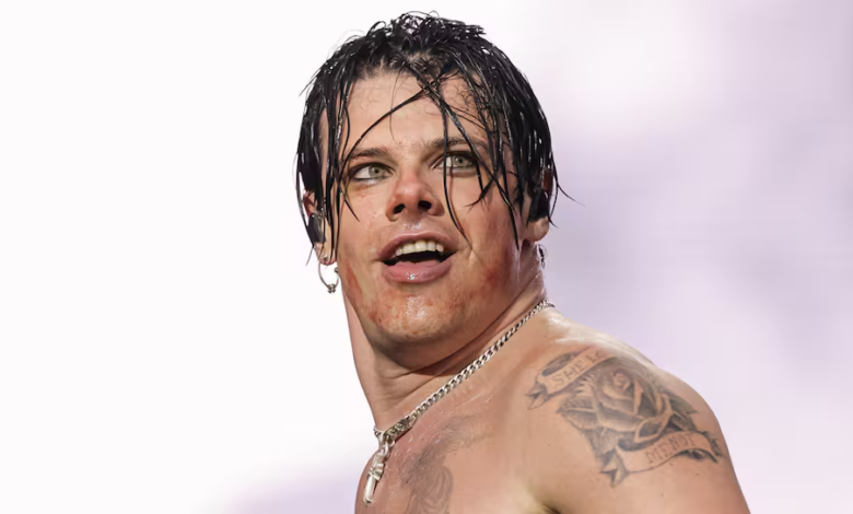 Yungblud sufre accidente en moto y toma una decisión sobre su gira
